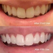 Load image into Gallery viewer, Whiten From Home With The Snow Teeth Whitening™ System
