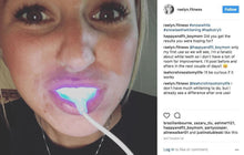 Load image into Gallery viewer, The Award Winning SNOW Teeth Whitening™ System