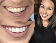 Load image into Gallery viewer, The Award Winning SNOW Teeth Whitening™ System