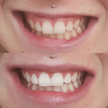 Load image into Gallery viewer, Turn Yellow Teeth White With The SNOW Whitening System
