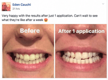 Load image into Gallery viewer, Turn Yellow Teeth White With The SNOW Whitening System
